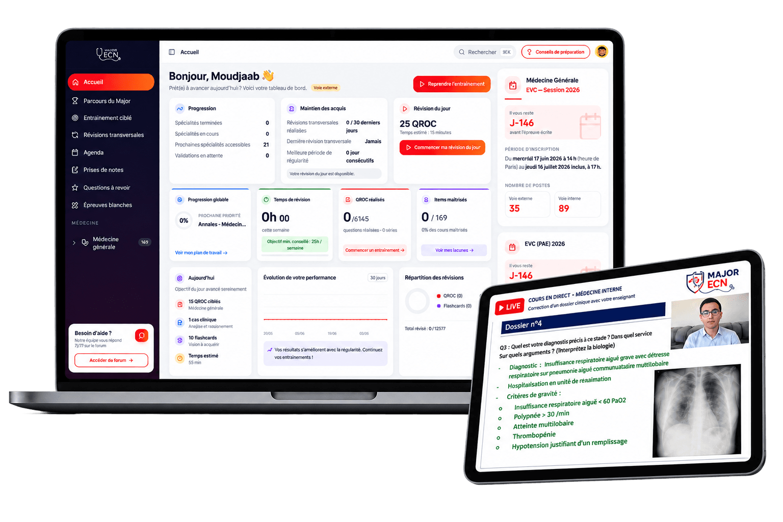Plateforme Major ECN — tableau de bord de préparation aux EVC et cours en direct avec un enseignant
